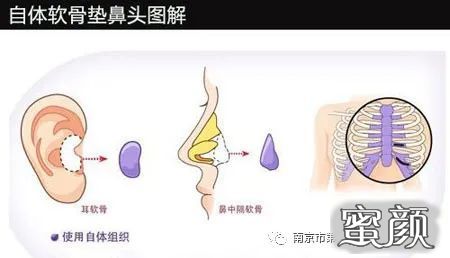 案例图片