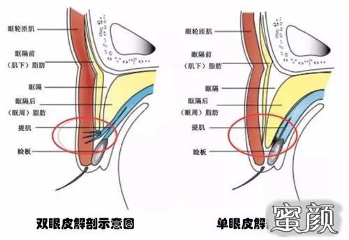 案例图片