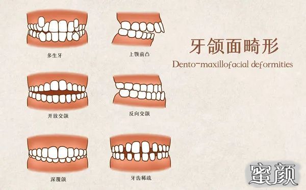 案例图片