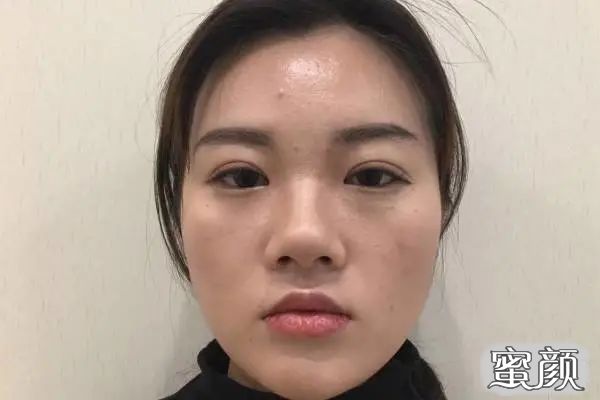 案例图片