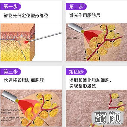 案例图片