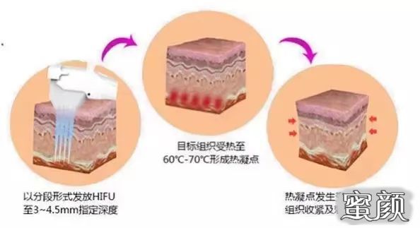 案例图片