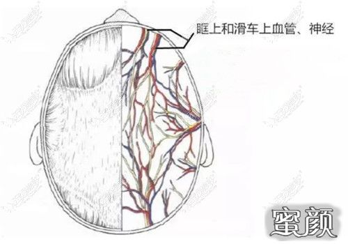 案例图片