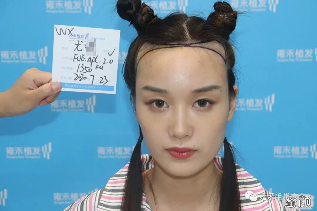 案例图片