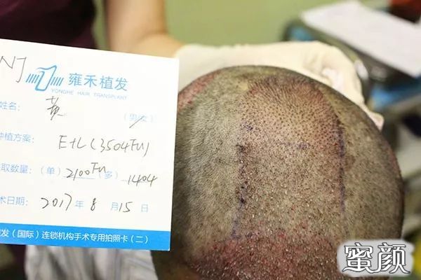 https://img.yiyiaimei.com/mnt/timg/210304/1200162008-7.jpg