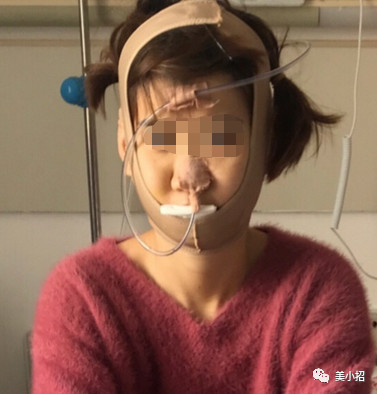 案例图片