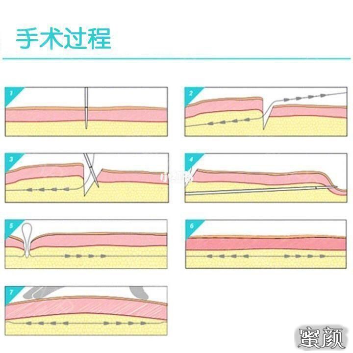 案例图片