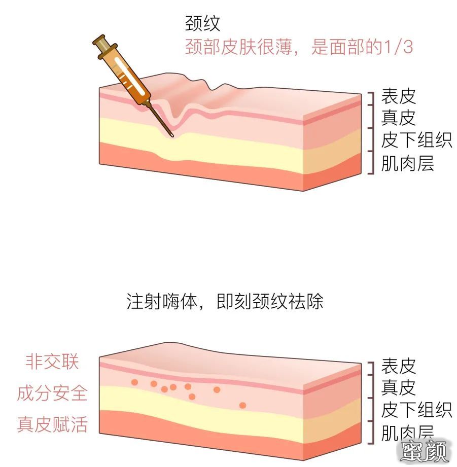 案例图片