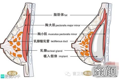 案例图片