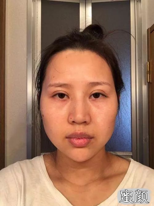 案例图片