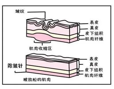 案例图片