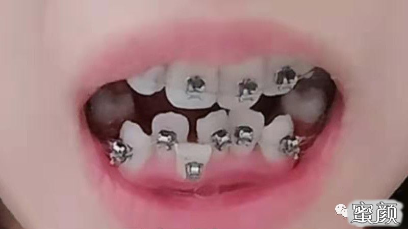 案例图片