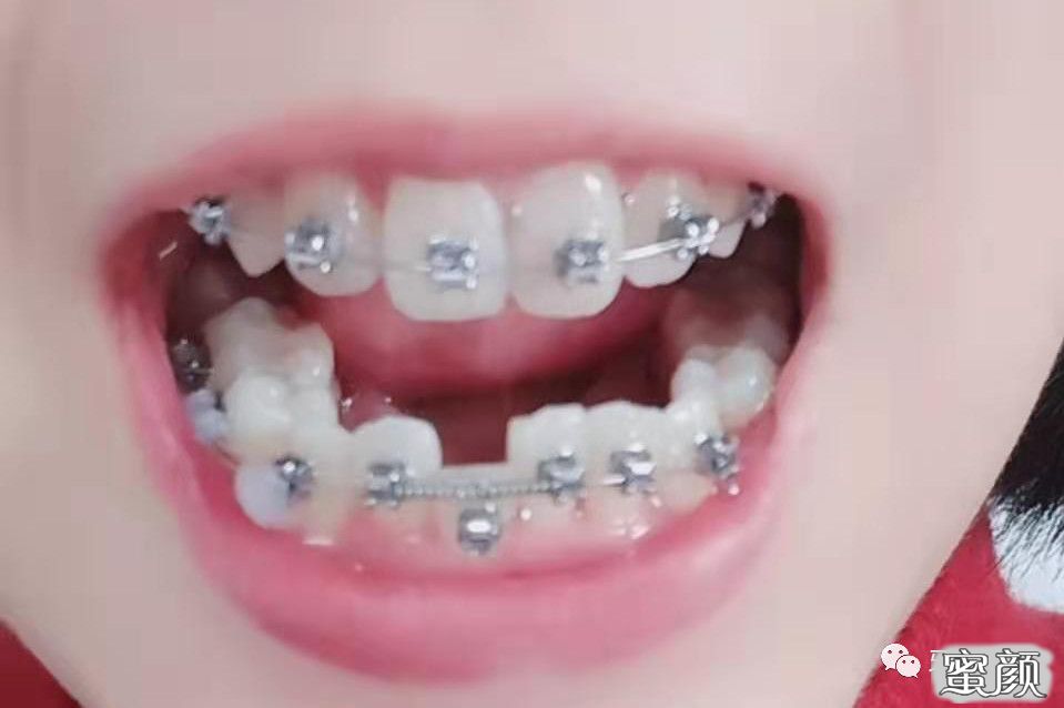 案例图片