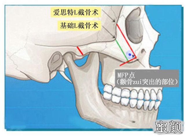 案例图片