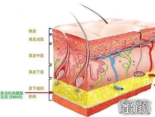 案例图片