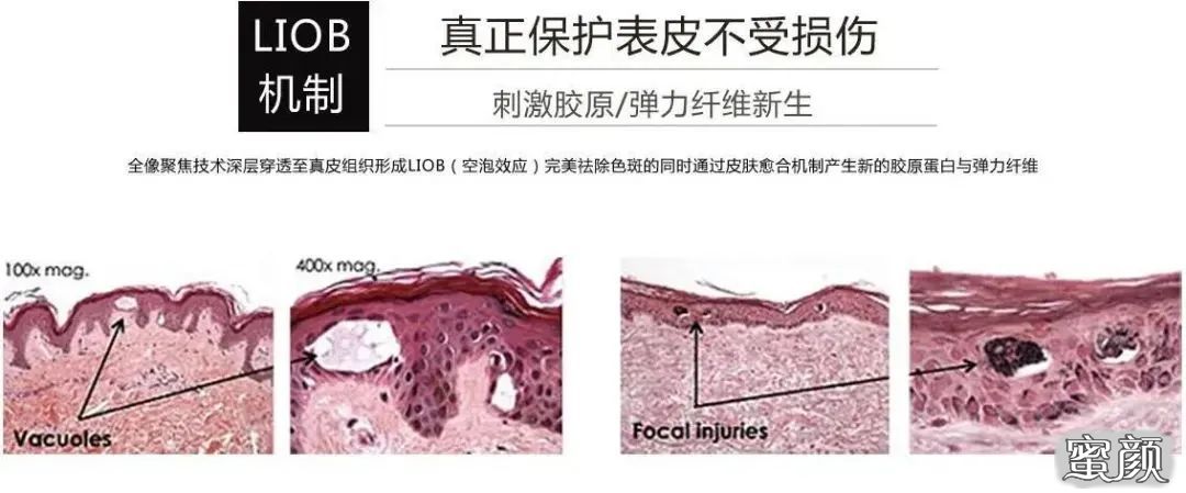 案例图片