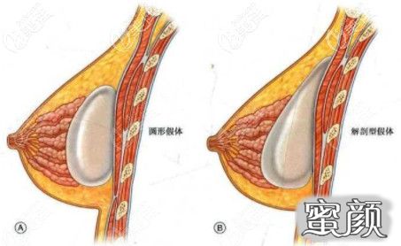 案例图片