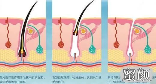 案例图片