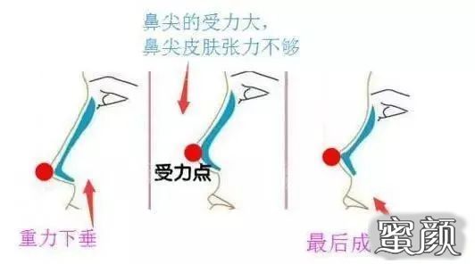 案例图片