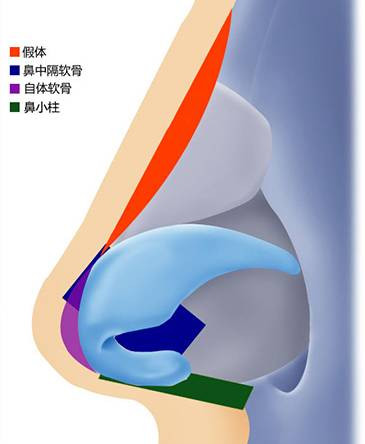 案例图片