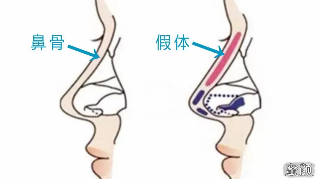 案例图片