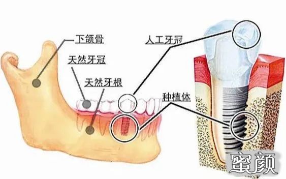 案例图片