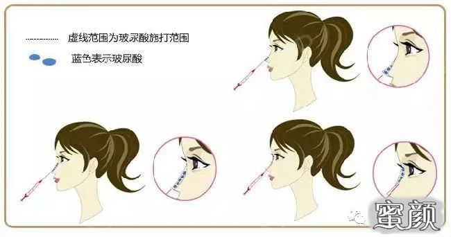 案例图片