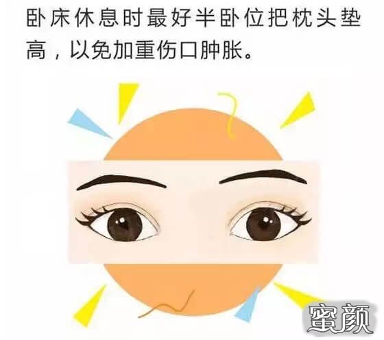 案例图片