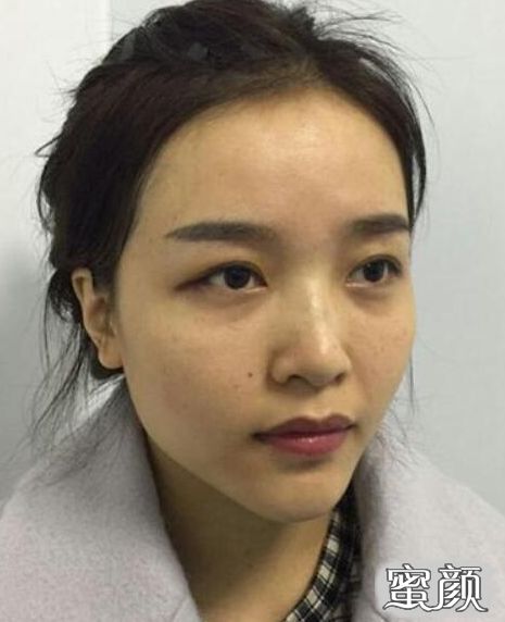 案例图片