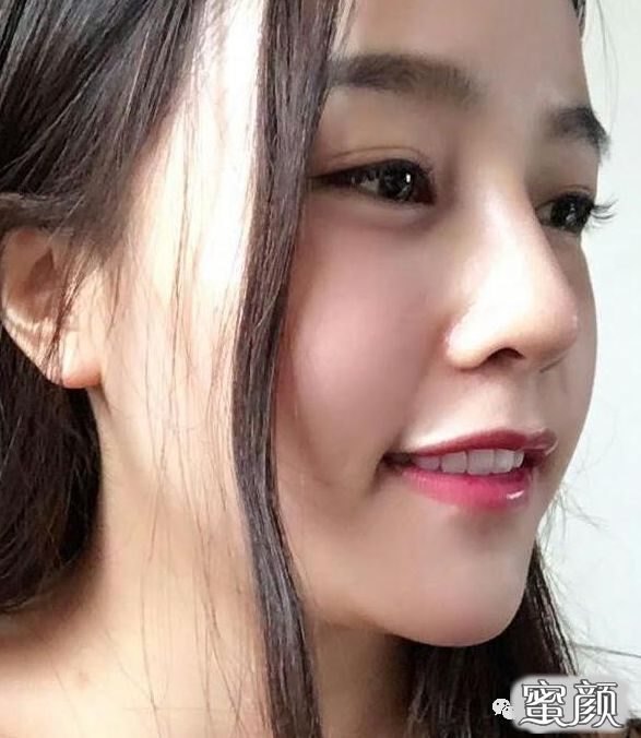 案例图片