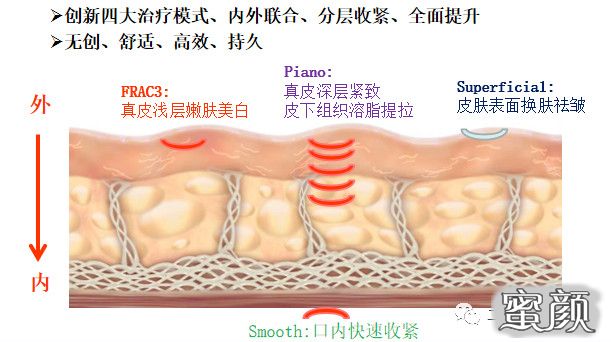 案例图片