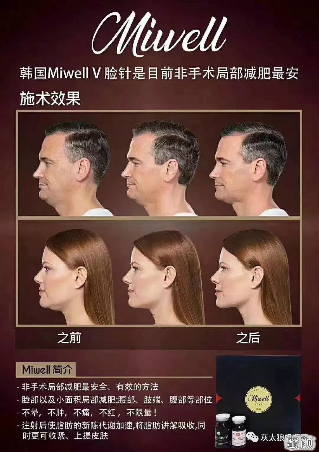 https://img.yiyiaimei.com/mnt/timg/210519/222Q43040-3.jpg