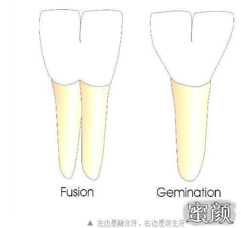 案例图片