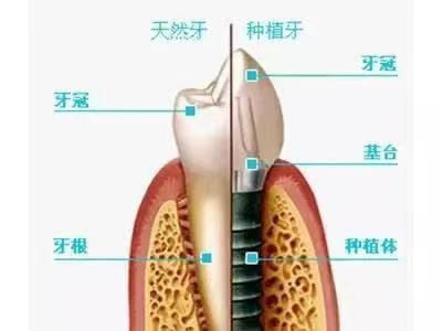 案例图片