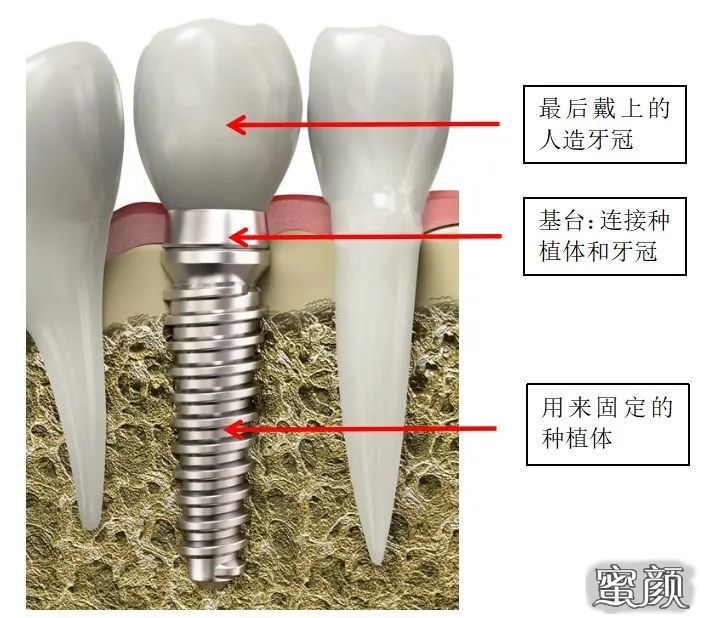 案例图片