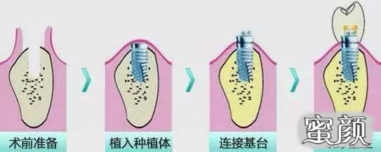 案例图片