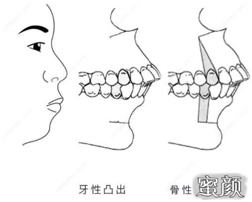 案例图片