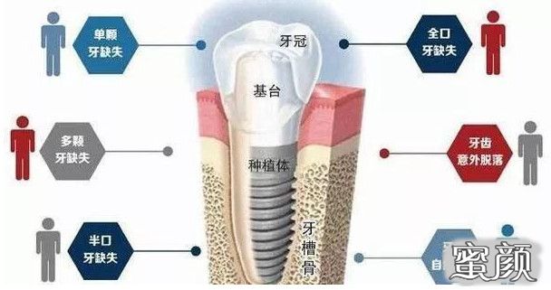 案例图片