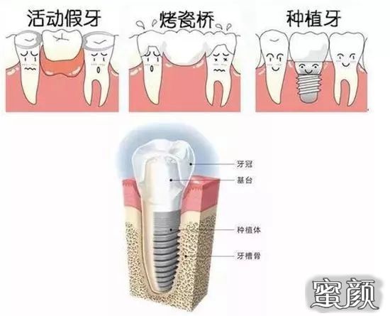 案例图片