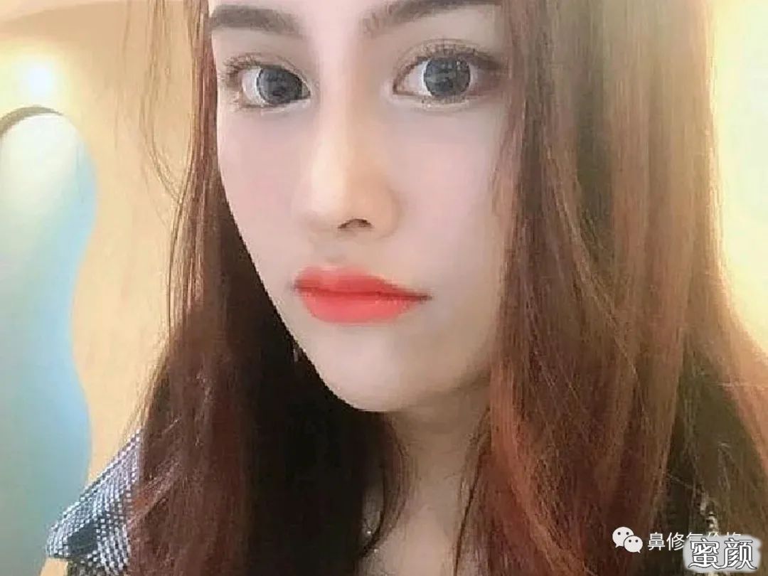 案例图片