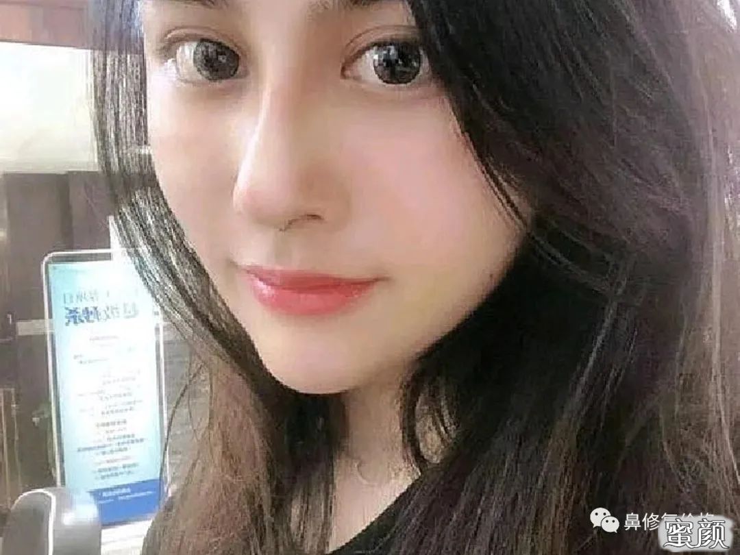 案例图片