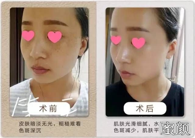 案例图片