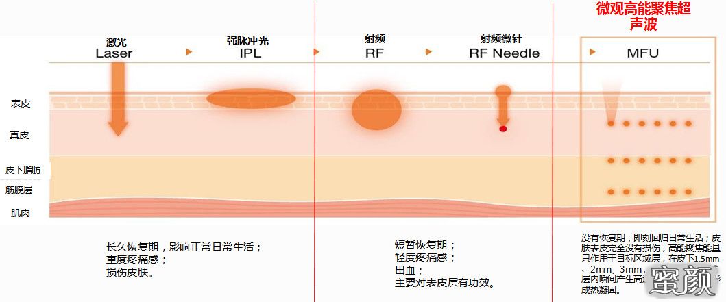 https://img.yiyiaimei.com/mnt/timg/210605/23261V040-2.jpg