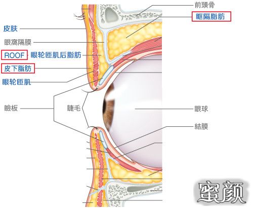 案例图片