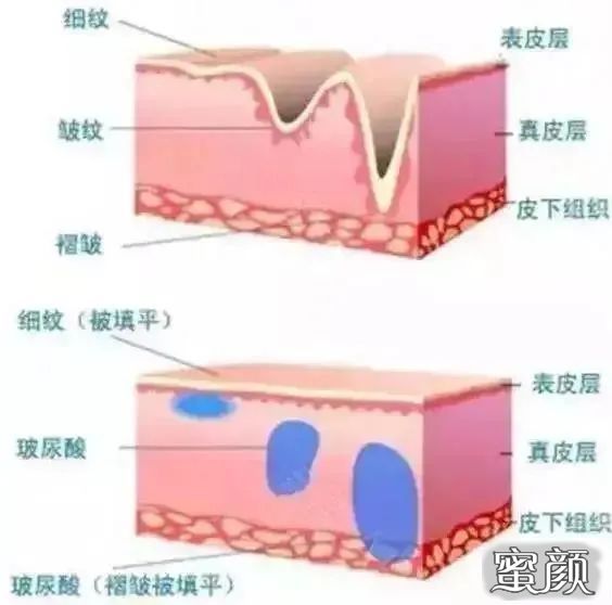 案例图片