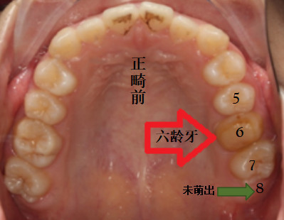 案例图片