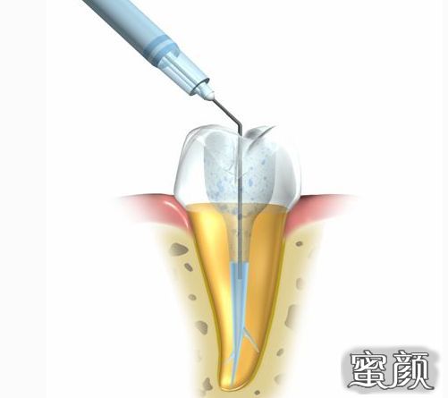 案例图片