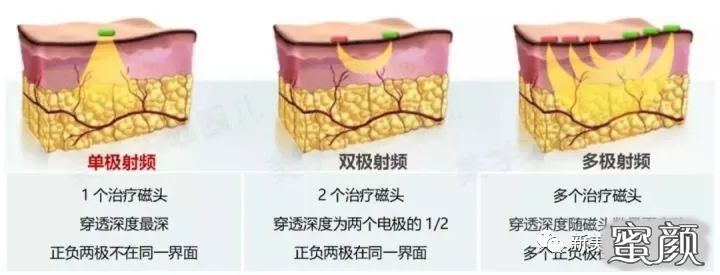 https://img.yiyiaimei.com/mnt/timg/210612/21014929E-6.jpg