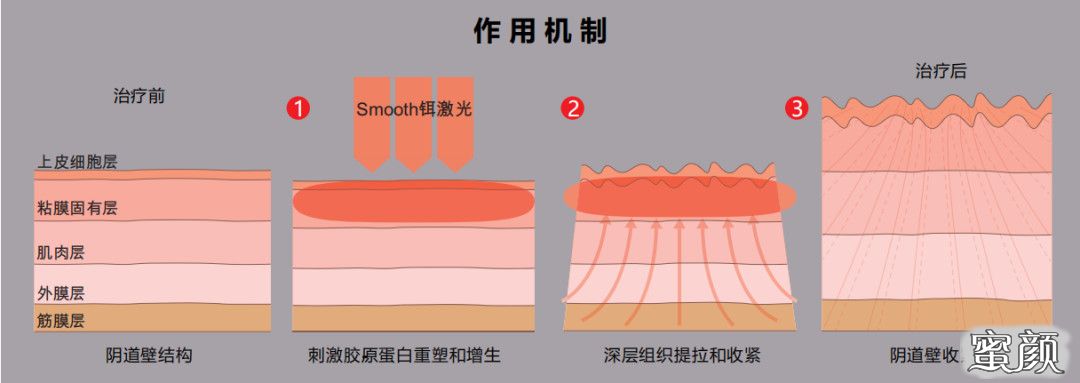 案例图片