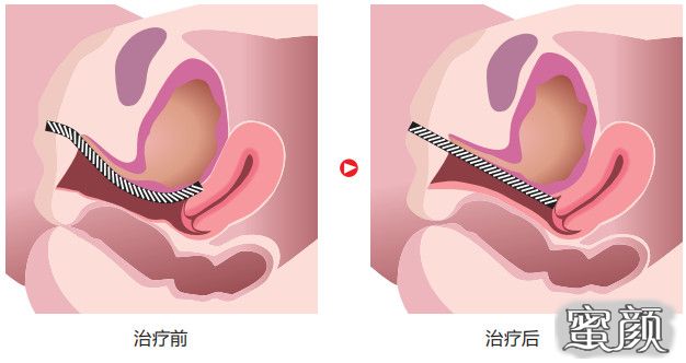 案例图片